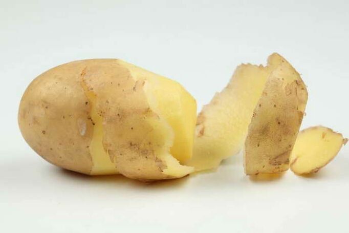 patatas para el tratamiento de la osteocondrosis cervical