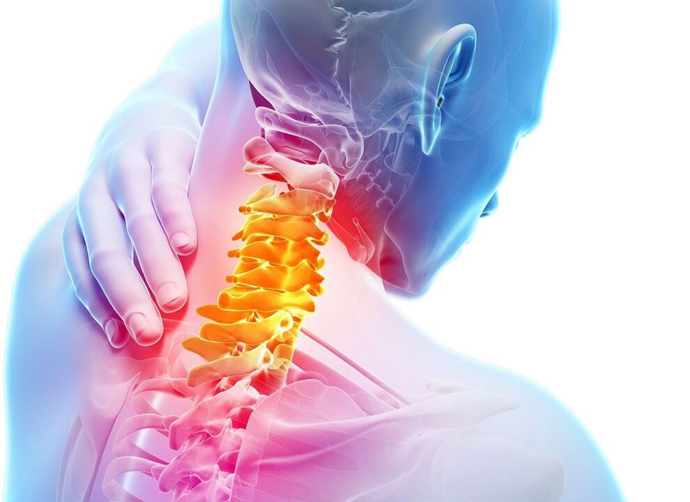 síntomas de osteocondrosis espinal