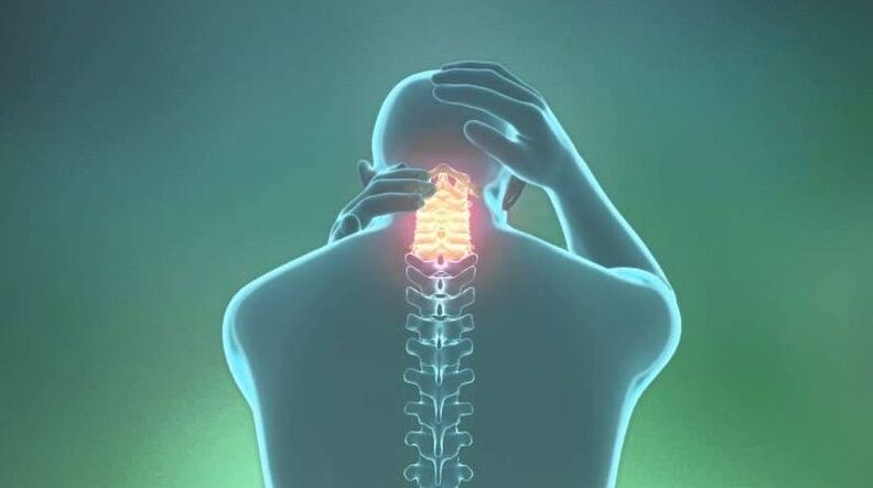 Osteocondrosis de la región cervical