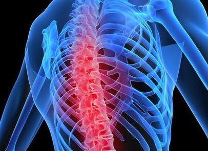 osteocondrosis de la columna torácica