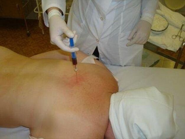 Preparaciones para la osteocondrosis