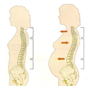 osteocondrosis durante el embarazo
